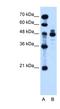 Indian Hedgehog Signaling Molecule antibody, NBP1-59443, Novus Biologicals, Western Blot image 