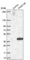 Uncharacterized protein C1orf183 antibody, NBP1-93888, Novus Biologicals, Western Blot image 