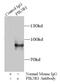 Phosphatidylinositol 3-kinase regulatory subunit alpha antibody, FNab06422, FineTest, Immunoprecipitation image 