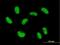 Zinc Finger Protein 468 antibody, H00090333-B01P, Novus Biologicals, Immunofluorescence image 