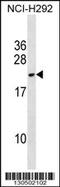 DPY30 Domain Containing 2 antibody, 60-197, ProSci, Western Blot image 
