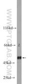 C-Type Lectin Domain Containing 14A antibody, 23964-1-AP, Proteintech Group, Western Blot image 