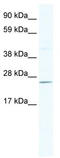 DnaJ Heat Shock Protein Family (Hsp40) Member C17 antibody, TA329988, Origene, Western Blot image 