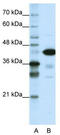 TAR DNA Binding Protein antibody, TA343674, Origene, Western Blot image 
