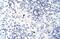 Zinc Finger And BTB Domain Containing 38 antibody, PA5-69063, Invitrogen Antibodies, Immunohistochemistry frozen image 