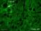 Vesicle Associated Membrane Protein 2 antibody, ab3347, Abcam, Immunofluorescence image 