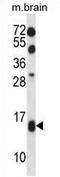 Elongin B antibody, AP54200PU-N, Origene, Western Blot image 
