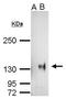 HA tag antibody, GTX628489, GeneTex, Immunoprecipitation image 