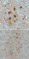 Charged Multivesicular Body Protein 2B antibody, MAB7509, R&D Systems, Immunohistochemistry paraffin image 