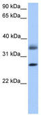 Galectin 8 antibody, TA335681, Origene, Western Blot image 