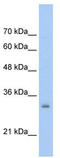 High mobility group nucleosome-binding domain-containing protein 5 antibody, TA331712, Origene, Western Blot image 