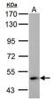 4-Aminobutyrate Aminotransferase antibody, GTX100479, GeneTex, Western Blot image 