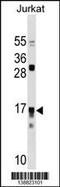 Interleukin 17 Receptor C antibody, 59-973, ProSci, Western Blot image 