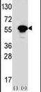 Syndapin 1 antibody, PA5-15353, Invitrogen Antibodies, Western Blot image 
