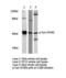 FYN Proto-Oncogene, Src Family Tyrosine Kinase antibody, LS-C175871, Lifespan Biosciences, Western Blot image 