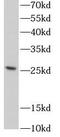 Progestin And AdipoQ Receptor Family Member 4 antibody, FNab06144, FineTest, Western Blot image 