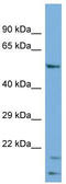 Cytochrome P450 Family 2 Subfamily R Member 1 antibody, TA338659, Origene, Western Blot image 