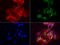 4-Aminobutyrate Aminotransferase antibody, LS-C796913, Lifespan Biosciences, Immunofluorescence image 