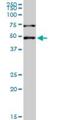 PHD Finger Protein 1 antibody, H00005252-M04, Novus Biologicals, Western Blot image 
