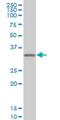 Cone-Rod Homeobox antibody, H00001406-M03, Novus Biologicals, Western Blot image 