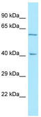 Reticulon 4 Receptor Like 2 antibody, TA331292, Origene, Western Blot image 