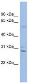 Gap junction beta-6 protein antibody, TA341667, Origene, Western Blot image 