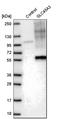 Solute carrier family 45 member 3 antibody, HPA019073, Atlas Antibodies, Western Blot image 