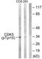 Cyclin Dependent Kinase 5 antibody, TA312175, Origene, Western Blot image 