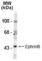 EPH Receptor B1 antibody, NB300-276, Novus Biologicals, Western Blot image 
