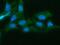Aldo-Keto Reductase Family 1 Member D1 antibody, A05278-2, Boster Biological Technology, Immunofluorescence image 