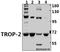 Prp1 antibody, A03569-1, Boster Biological Technology, Western Blot image 