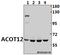 Acyl-coenzyme A thioesterase 12 antibody, A11589, Boster Biological Technology, Western Blot image 