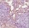 Fibroblast antibody, NB100-64932, Novus Biologicals, Immunohistochemistry paraffin image 