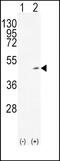 Alcohol Dehydrogenase 1C (Class I), Gamma Polypeptide antibody, 61-966, ProSci, Western Blot image 