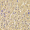 Peroxisomal Biogenesis Factor 5 antibody, LS-C334286, Lifespan Biosciences, Immunohistochemistry frozen image 