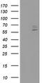Cytochrome P450 Family 2 Subfamily J Member 2 antibody, TA503482, Origene, Western Blot image 
