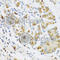 Ribonuclease A Family Member 3 antibody, A1854, ABclonal Technology, Immunohistochemistry paraffin image 
