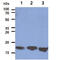 LSM5 Homolog, U6 Small Nuclear RNA And MRNA Degradation Associated antibody, GTX57641, GeneTex, Western Blot image 