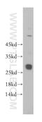 Glutathione S-Transferase Theta 2B (Gene/Pseudogene) antibody, 17622-1-AP, Proteintech Group, Western Blot image 