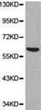 Karyopherin Subunit Alpha 1 antibody, TA321461, Origene, Western Blot image 