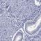 Acrosin Binding Protein antibody, HPA039081, Atlas Antibodies, Immunohistochemistry paraffin image 