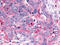 Growth Hormone Releasing Hormone Receptor antibody, TA340756, Origene, Immunohistochemistry paraffin image 