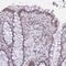 HMGN1 antibody, HPA048694, Atlas Antibodies, Immunohistochemistry paraffin image 