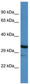 Myocilin antibody, TA342733, Origene, Western Blot image 