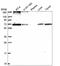 Dolichyl-diphosphooligosaccharide--protein glycosyltransferase subunit 1 antibody, HPA051520, Atlas Antibodies, Western Blot image 