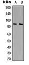 UTP14A Small Subunit Processome Component antibody, LS-B14521, Lifespan Biosciences, Western Blot image 