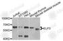 Elongator complex protein 3 antibody, A9877, ABclonal Technology, Western Blot image 