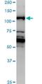 Junction Mediating And Regulatory Protein, P53 Cofactor antibody, H00133746-M01, Novus Biologicals, Western Blot image 