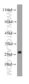 HGb antibody, 60228-1-Ig, Proteintech Group, Western Blot image 