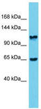 Myosin Phosphatase Rho Interacting Protein antibody, TA344565, Origene, Western Blot image 